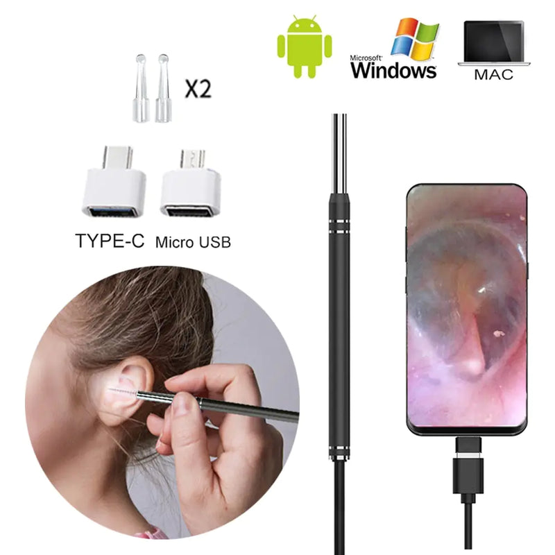 Smart Earwax Removal Tool w/ Camera